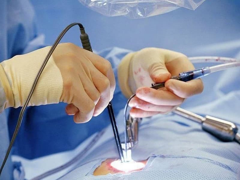 Cân nhắc thời điểm phẫu thuật hay điều trị lớn cho nam Kỷ Dậu