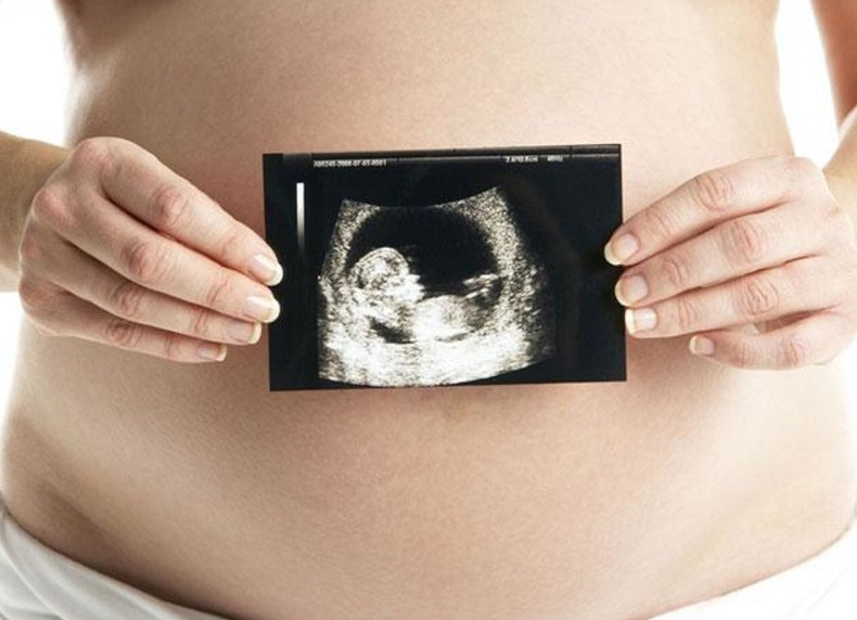 Hình ảnh siêu âm bé trai 17 tuần cho thấy rõ các đặc điểm của cơ quan sinh dục, hỗ trợ nhận biết giới tính.